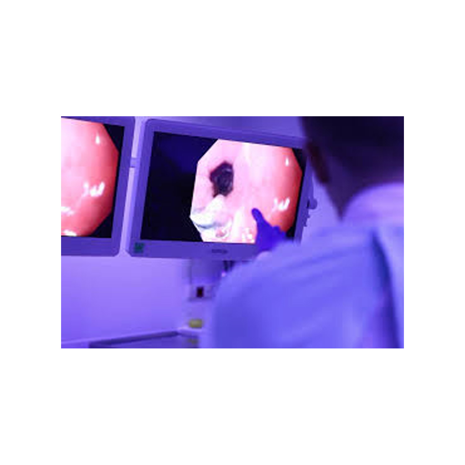 KING-NL-Endoscopie