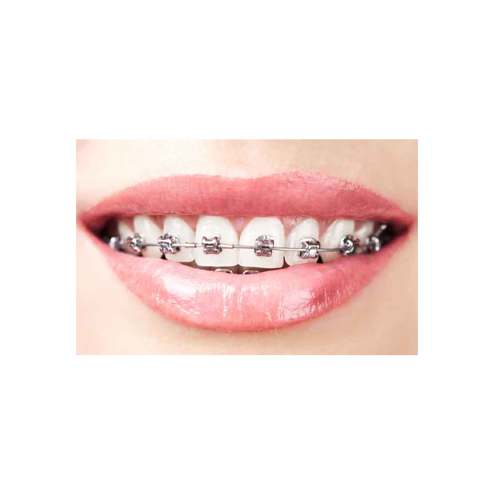 KING-NL-Orthodontie