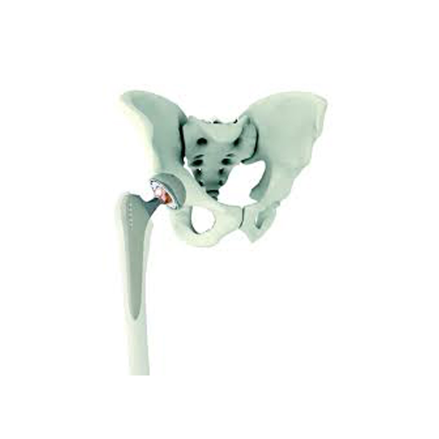 KING-NL-Orthopedie