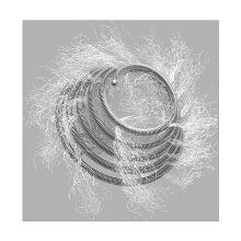 Tornado Embolisation Coil 0.018 Coiled embolus tapering diameter 10 - 5 Artikel foto
