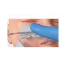 Grip-Lok nasal gastric securement Artikel foto
