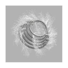 Microcoil embolization tornado 18sx10cmx5mm Artikel foto