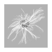 Embolization coil mreye 35sx10cmx10mm Artikel foto