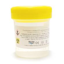 250ml container/gele secure dop gevuld met 100ml neutrale formaldehyde 4% gebuff Artikel foto