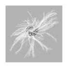 Embolization coil mreye 35sx10cmx10mm Artikel foto