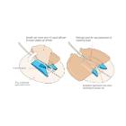 Drain-Guard fixatiepleister voor percutane drains (5-16fr) Artikel foto