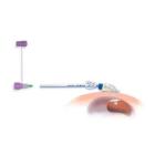 Nutricia flocare peg set Ch14 Artikel foto