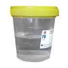 500ml beker plp met gele sec schroefst+200ml neutrale formaldehyde 4% gebufferd Artikel foto
